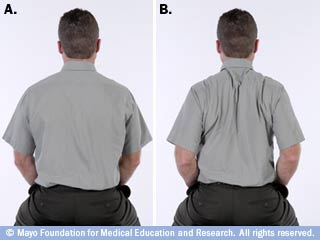 Back-pain7.jpg