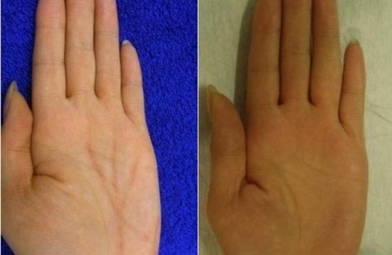 hand2