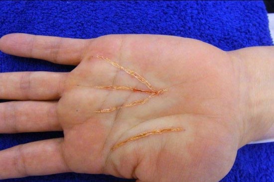 hand3