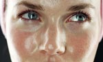 Oily-face1