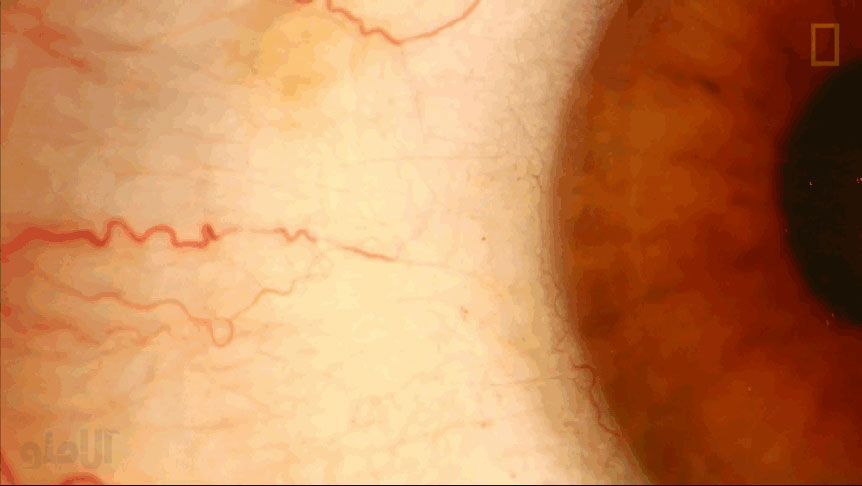 eye1