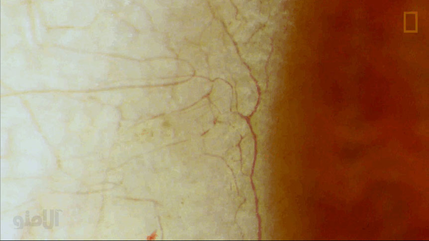 eye2