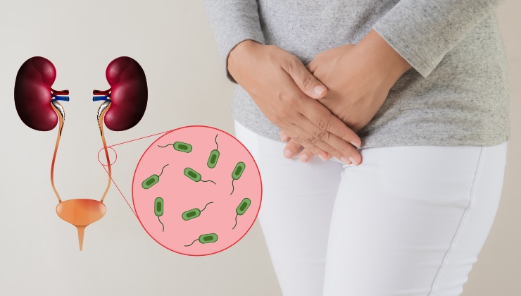 عفونت ادراری از چی میاد و برای آن چی بخوریم