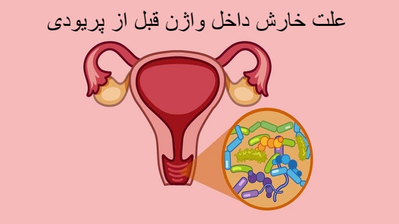 علت خارش داخل واژن قبل از پریودی