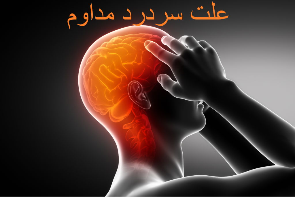 علت سردرد مداوم