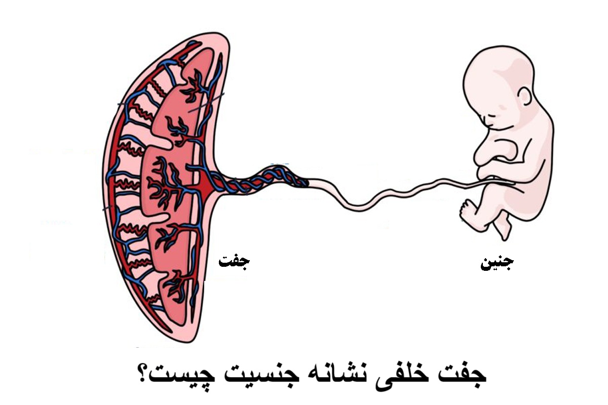 جفت خلفی نشانه جنسیت چیست؟