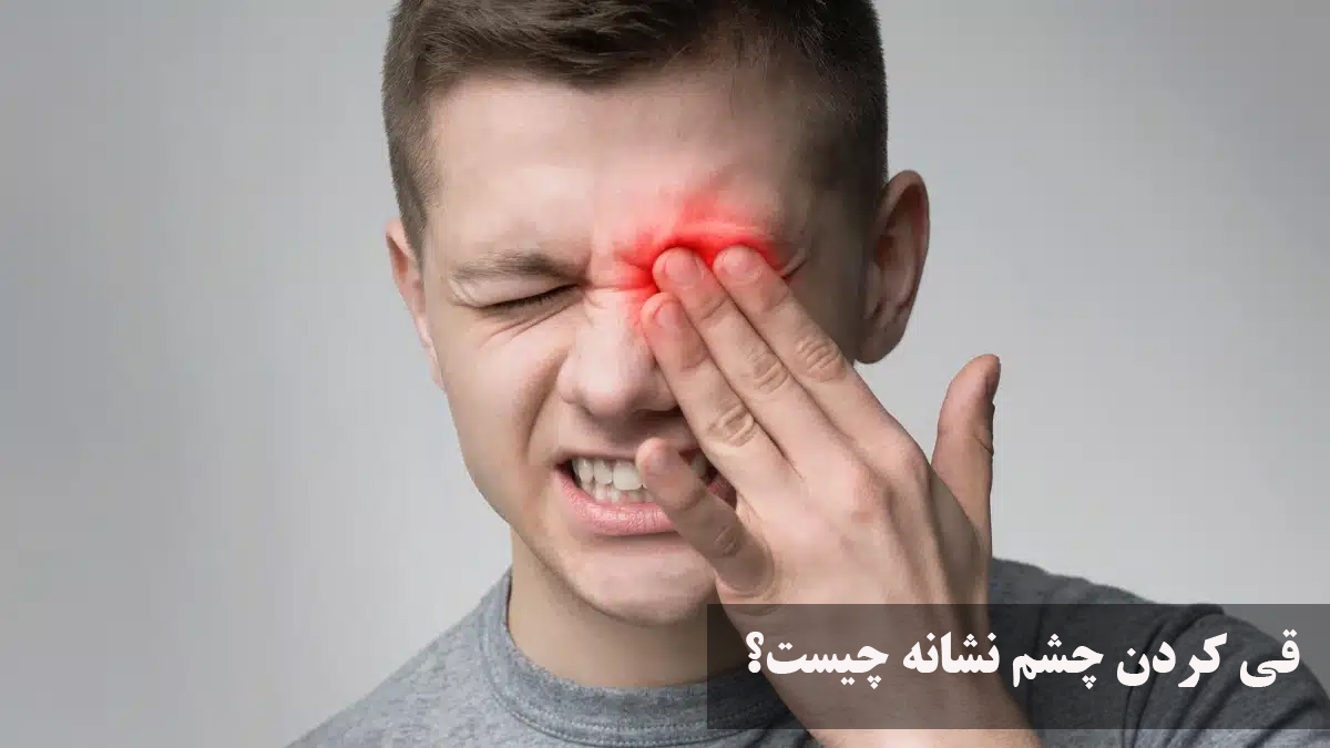 قی کردن چشم