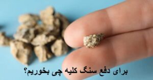 برای دفع سنگ کلیه چی بخوریم؟