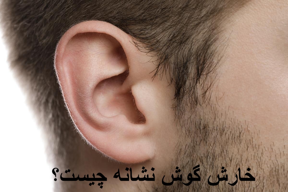 خارش گوش نشانه چیست؟