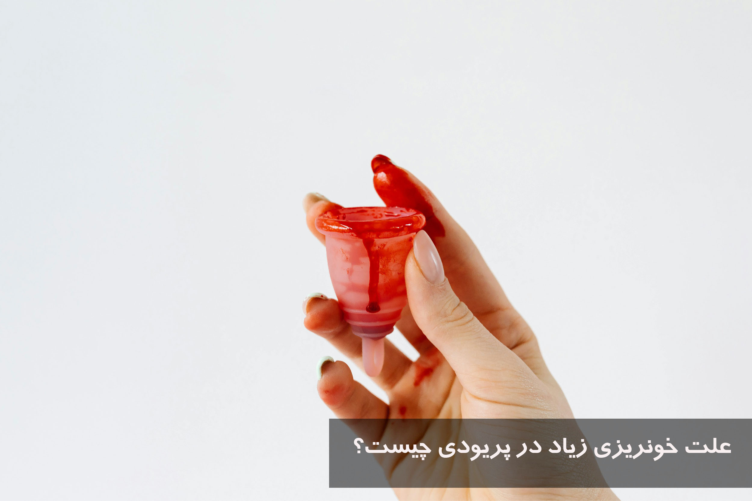 علت خونریزی زیاد در پریودی چیست؟
