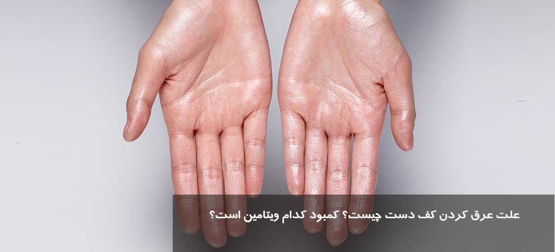 علت عرق کردن کف دست چیست؟ کمبود کدام ویتامین است؟