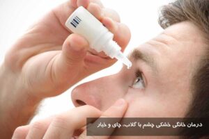 درمان خانگی خشکی چشم با گلاب، چای و خیار