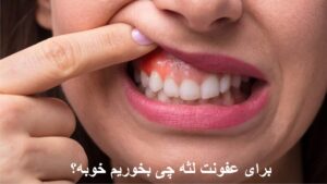 برای عفونت لثه چی بخوریم خوبه؟