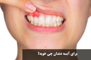 برای آبسه دندان چی خوبه؟