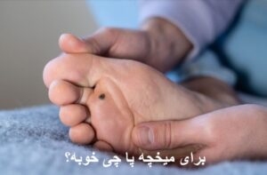 برای میخچه پا چی خوبه؟