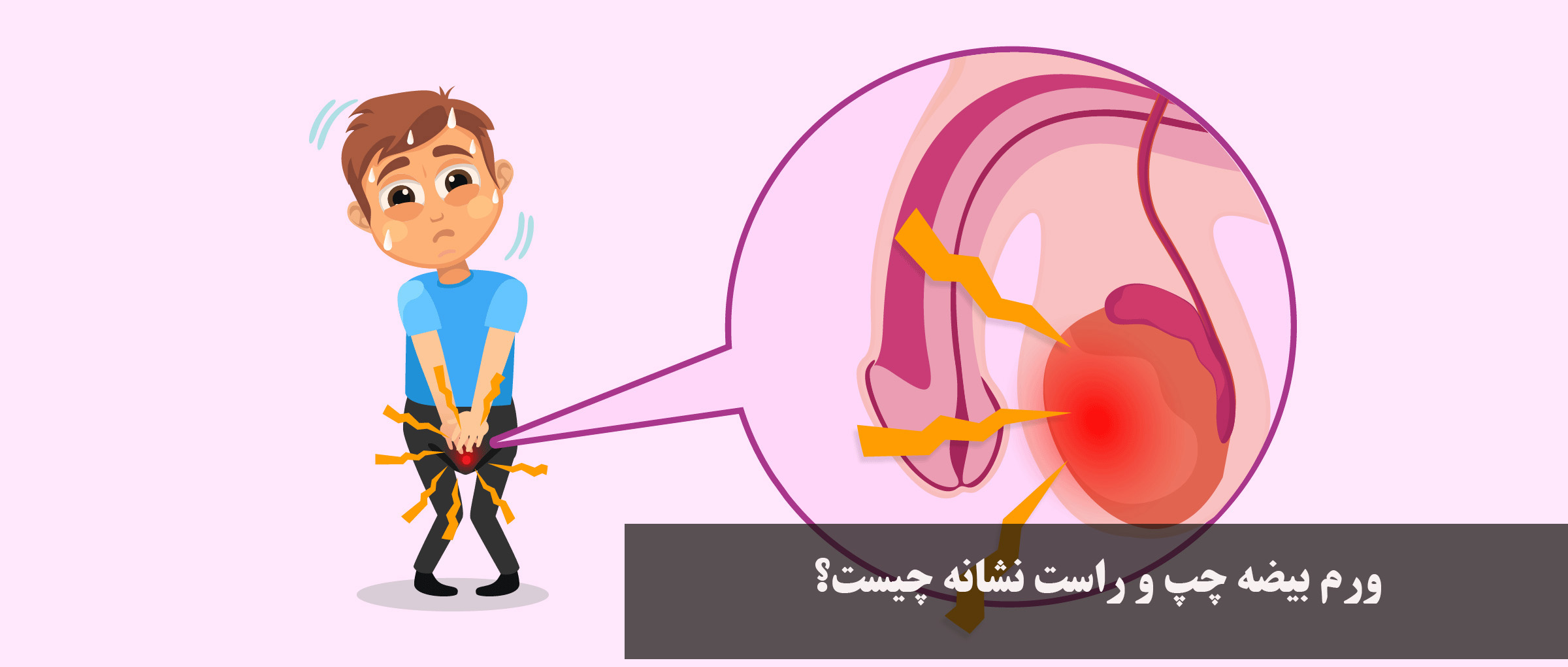 ورم بیضه چپ و راست نشانه چیست؟