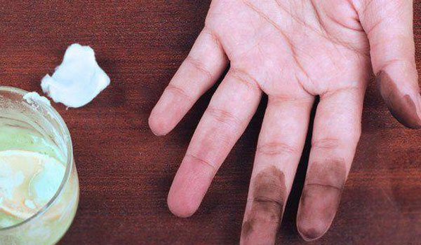 بهترین روش روش پاك كردن رنگ مو از روي پوست دست