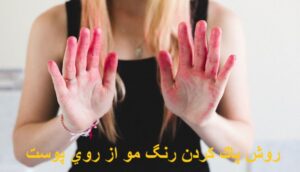 بهترین روش پاك كردن رنگ مو از روي پوست دست و صورت