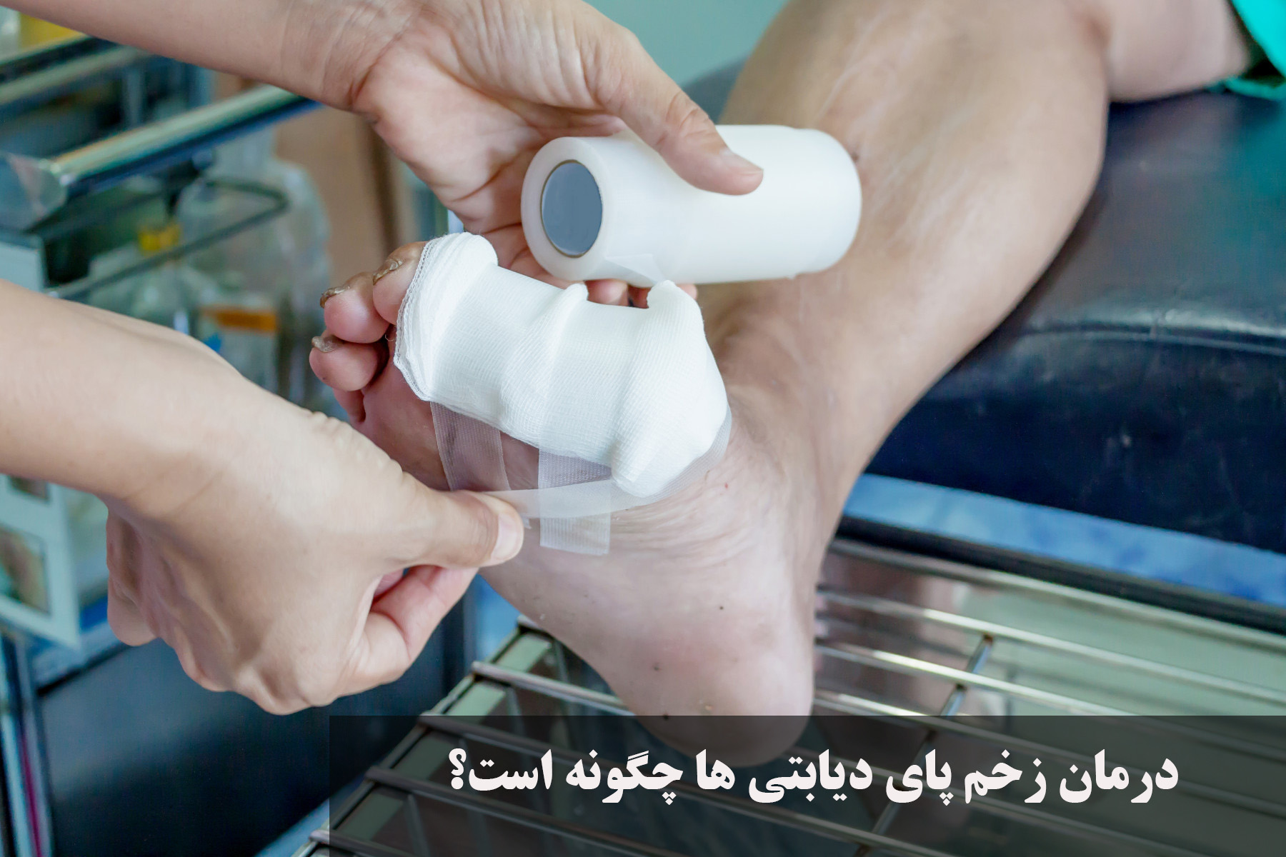 درمان زخم پای دیابتی ها چگونه است؟