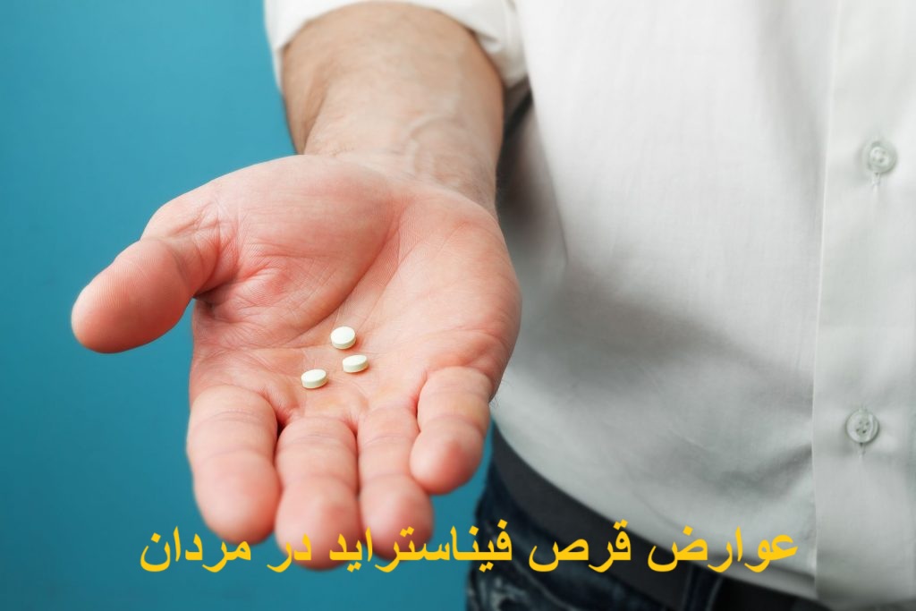 عوارض قرص فیناستراید در مردان