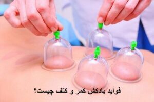 فواید بادکش کمر و کتف چیست؟