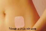 چسب ضد بارداری چیست؟