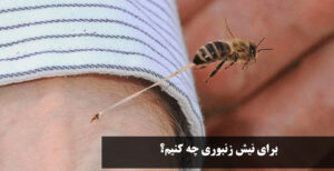 درمان خانگی خارش نیش زنبور