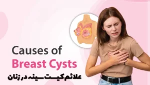 علائم کیست سینه در زنان