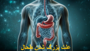 علت بزرگ شدن طحال
