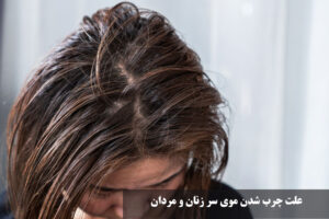 علت چرب شدن موی سر زنان و مردان