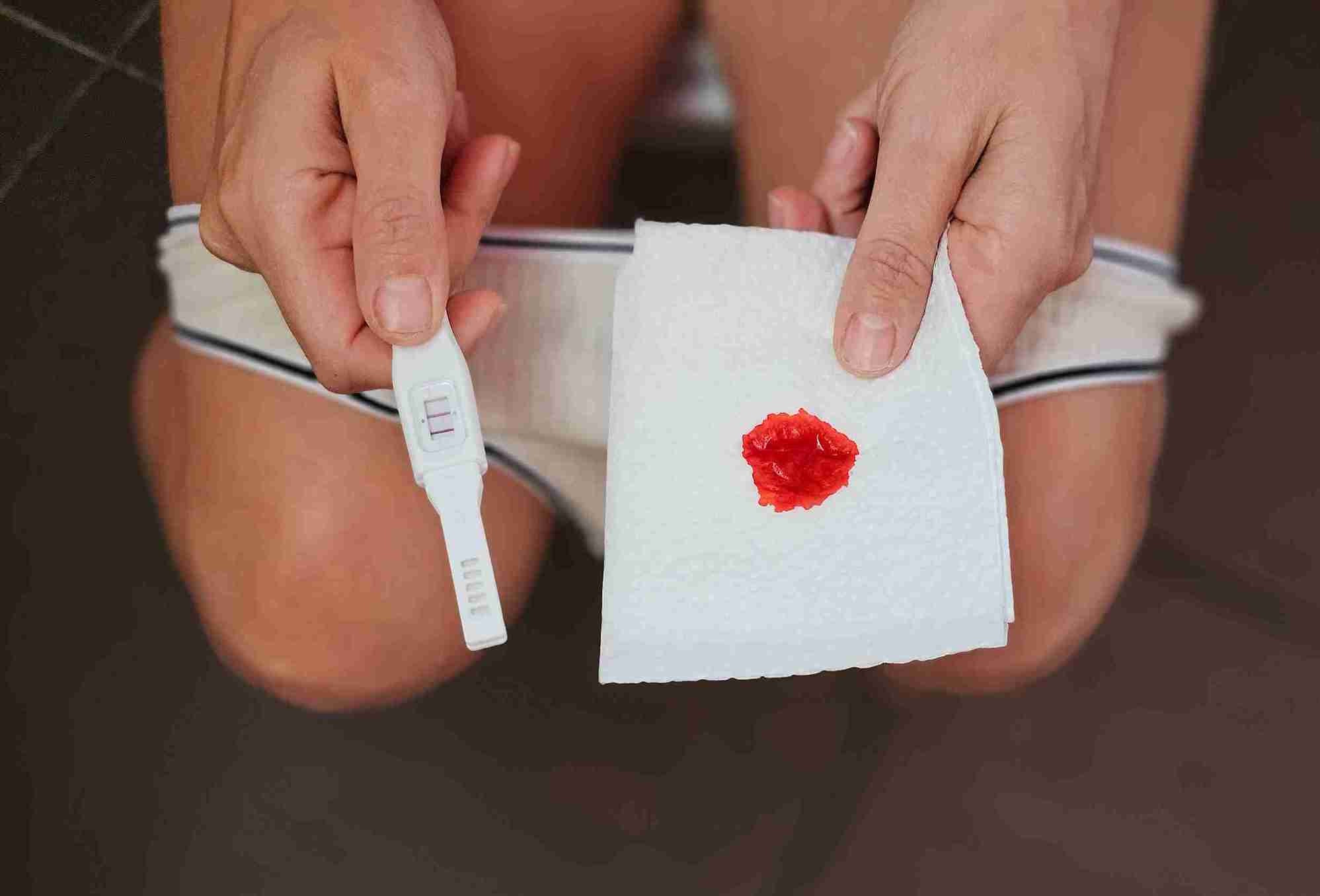 چه بخوریم تا خونریزی در بارداری قطع شود؟