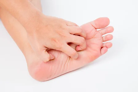 علت خارش پاشنه پا در صبح