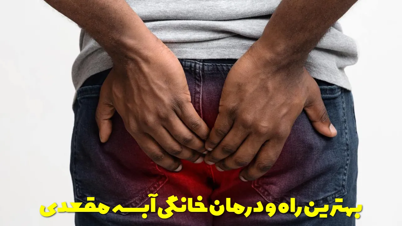 بهترین راه و درمان خانگی آبسه مقعدی