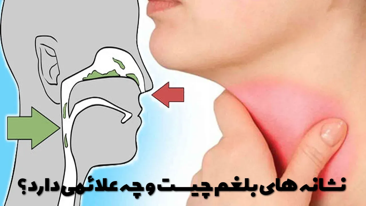 نشانه های بلغم چیست و چه علائمی دارد؟