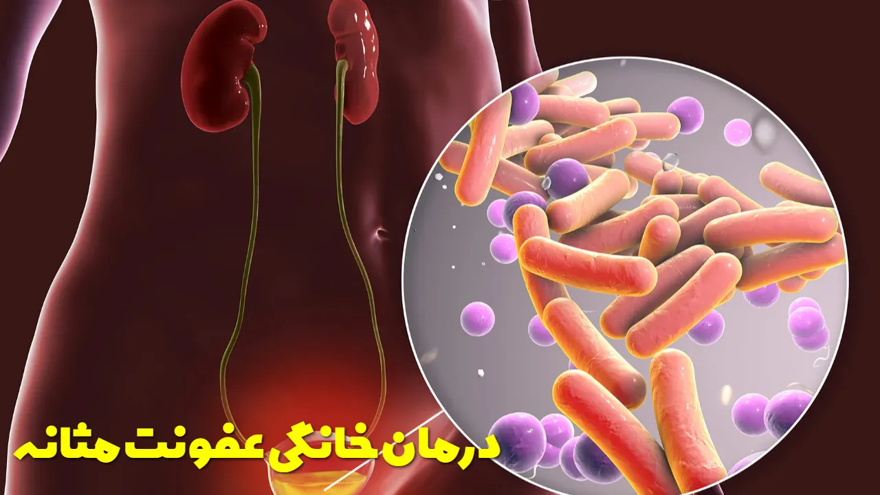 درمان خانگی عفونت مثانه