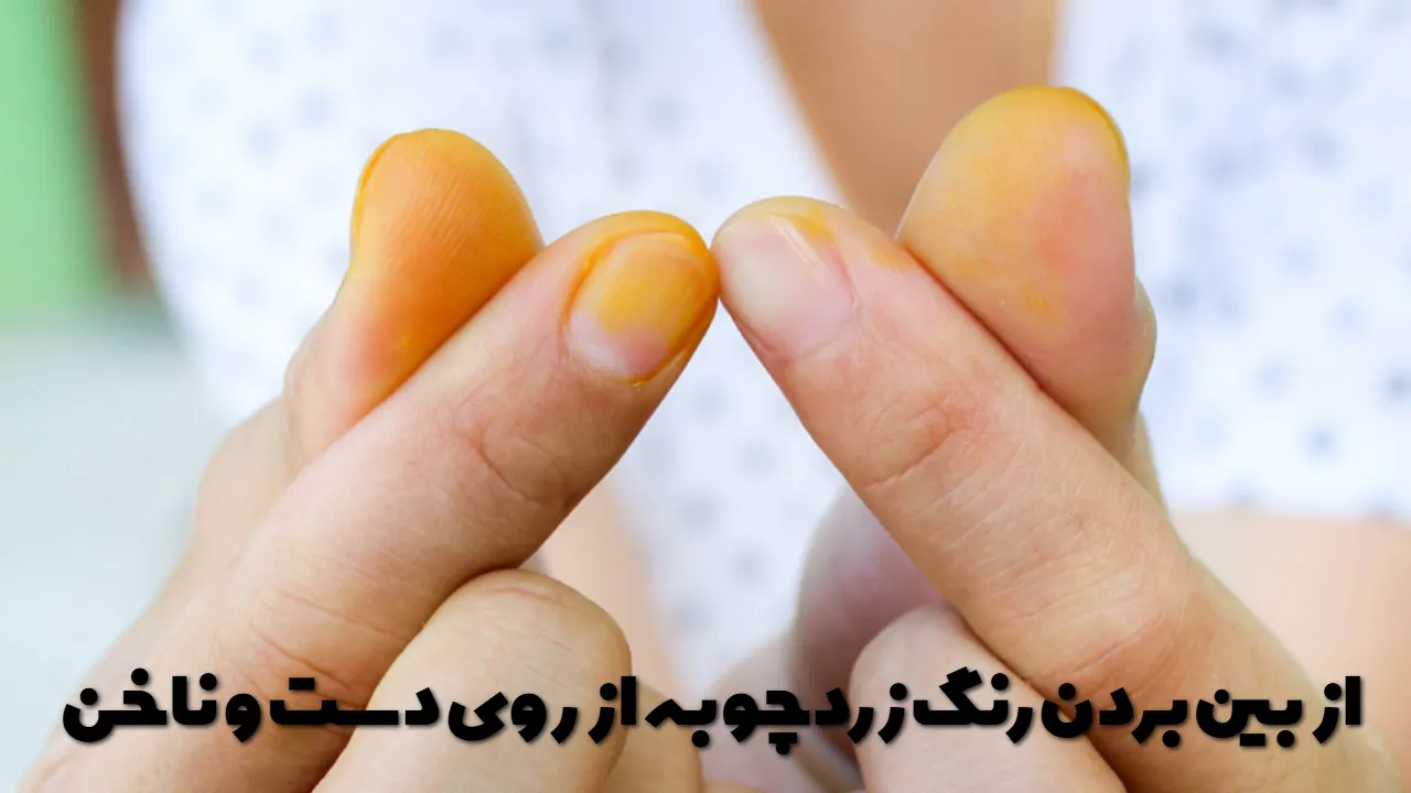 از بین بردن رنگ زردچوبه از روی دست و ناخن