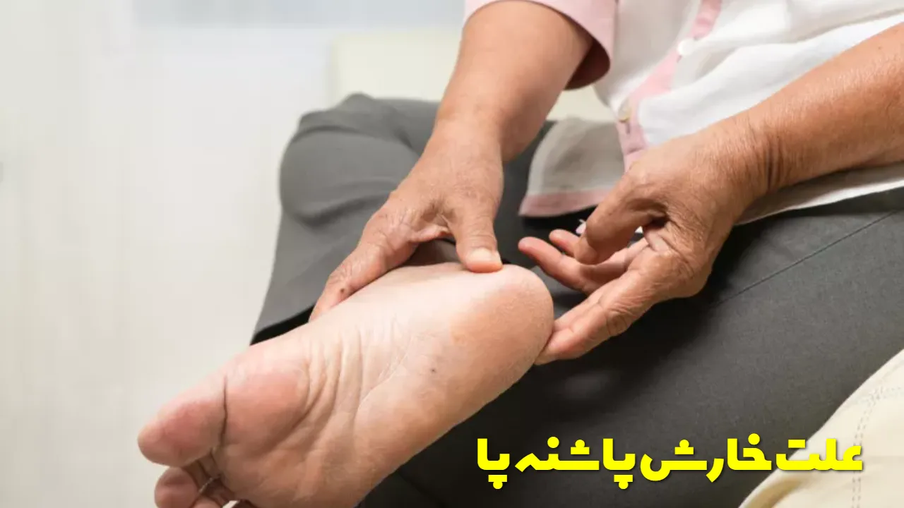 علت خارش پاشنه پا
