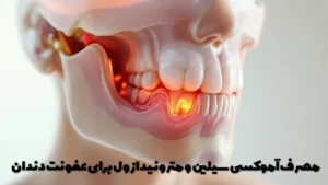 مصرف آموکسی سیلین و مترونیدازول برای عفونت دندان