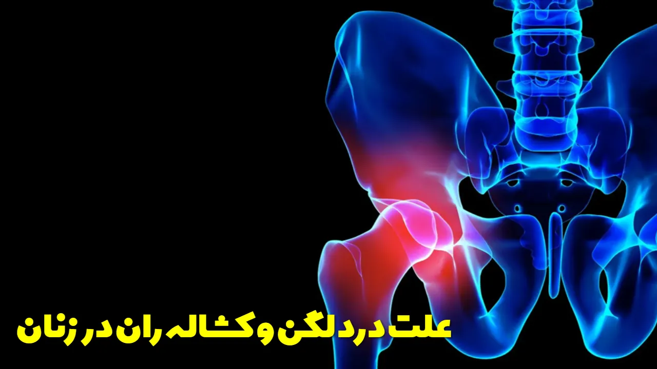 علت درد لگن و کشاله ران در زنان