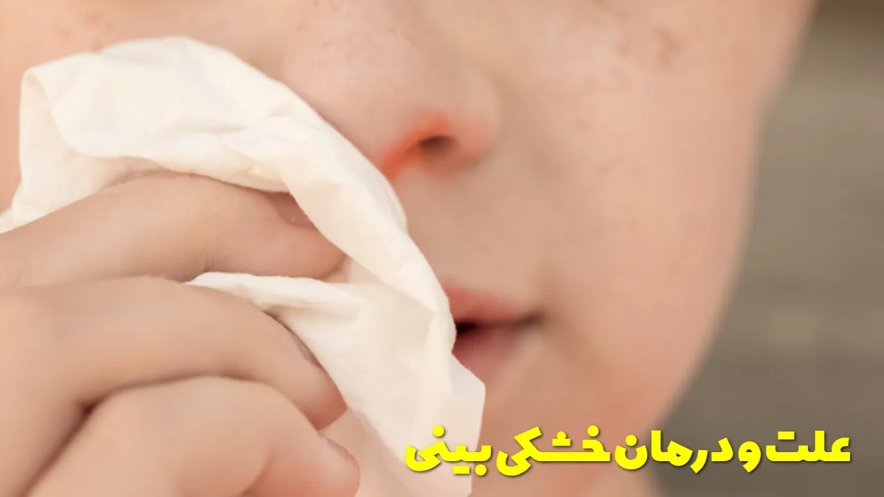 علت و درمان خشکی بینی