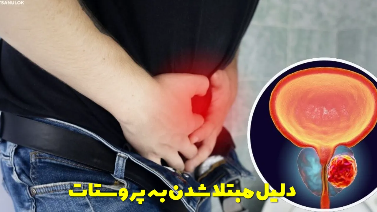 دلیل مبتلا شدن به پروستات چیست