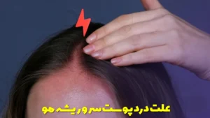 علت درد پوست سر و ریشه مو
