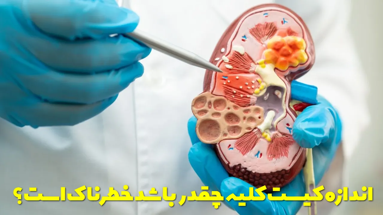 اندازه کیست کلیه چقدر باشد خطرناک است؟