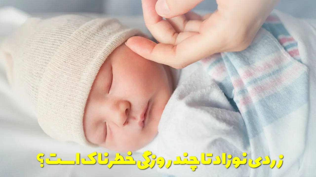 زردی نوزاد تا چند روزگی خطرناک است؟