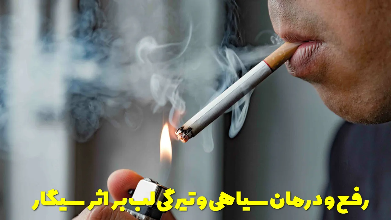 رفع و درمان سیاهی و تیرگی لب بر اثر سیگار