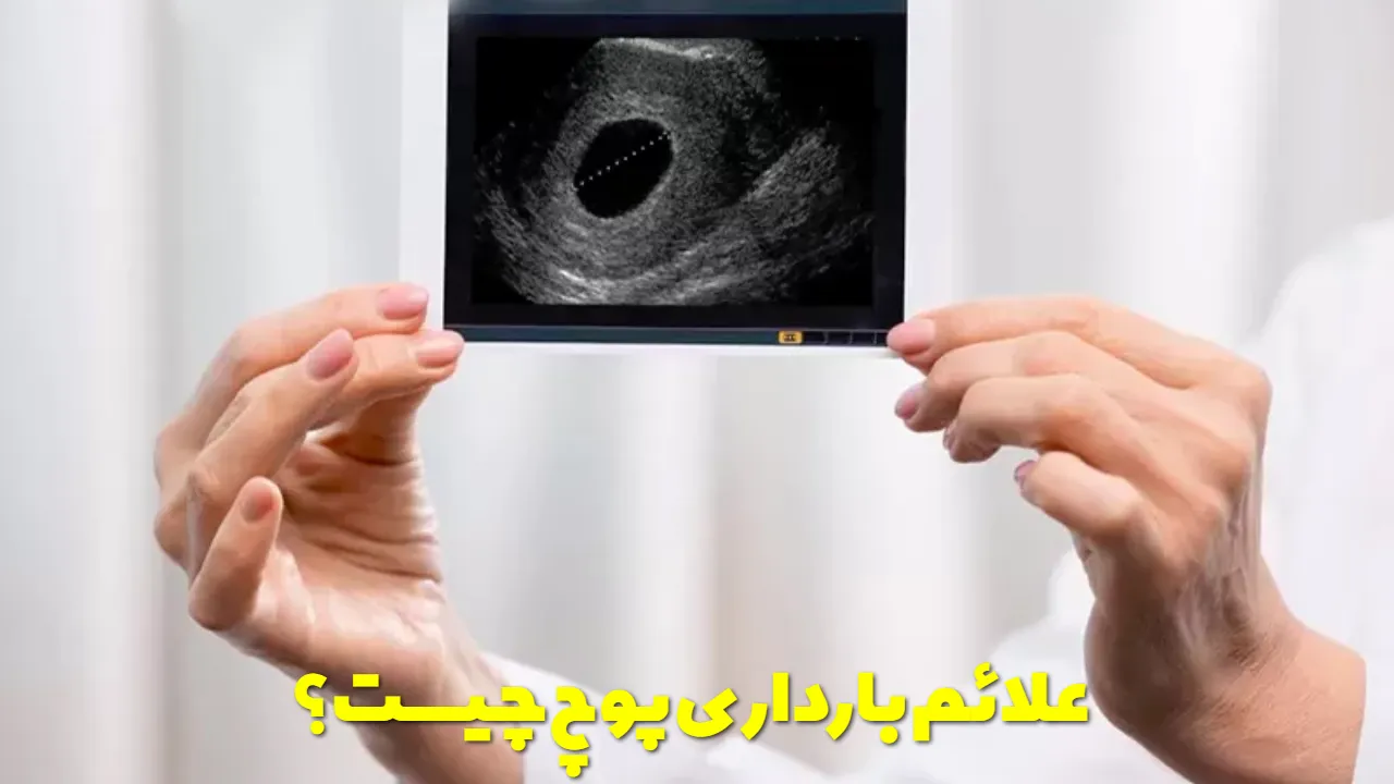 علائم بارداری پوچ چیست