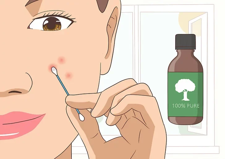 نقش روغن درخت چای در كنترل جوش