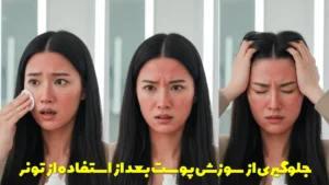 جلوگیری از سوزش پوست بعد از استفاده از تونر