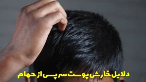 دلایل خارش پوست سر پس از حمام