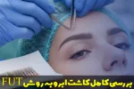 بررسی کامل کاشت ابرو به روش FUT